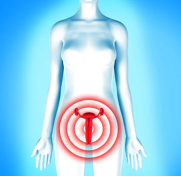 Menstruationsschmerzen Der Anatomie Illustration Pms Bild — Stockfoto