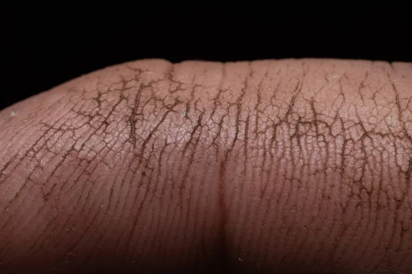 Dry Cracked Skin Dirt Earthworks Garden Macro Close — Stock Photo, Image