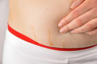 Kadın gösteren streç işaretleri 