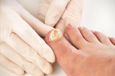 checking the disease big toe clipart
