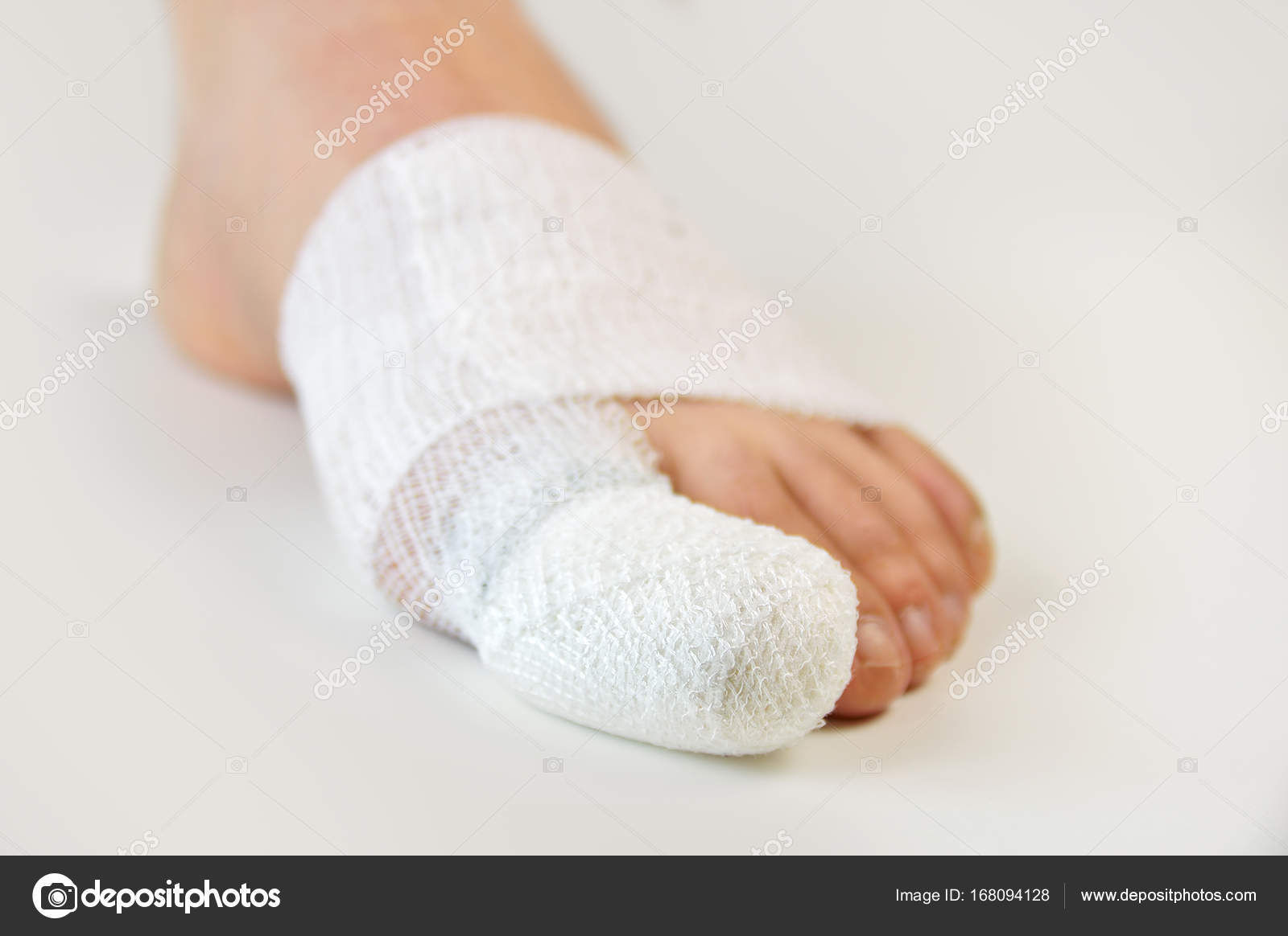 Heridas entre los dedos del pie