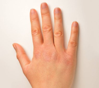 solmuş el soğuk hava ile