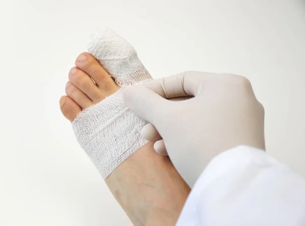 Médico curando el dedo del pie del paciente — Foto de Stock