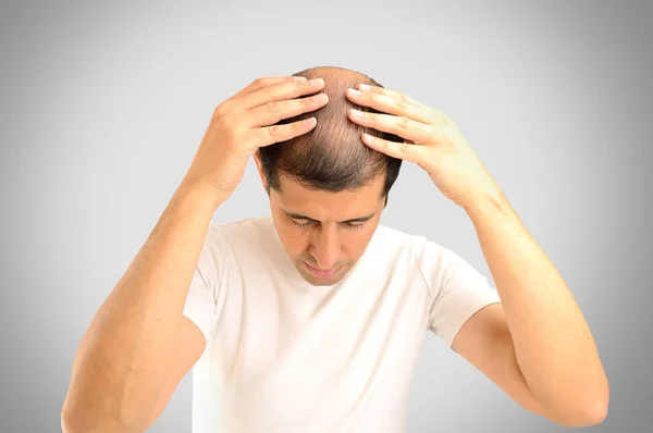 Worried by my hair loss — Stock Photo, Image