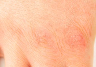 solmuş el soğuk hava ile