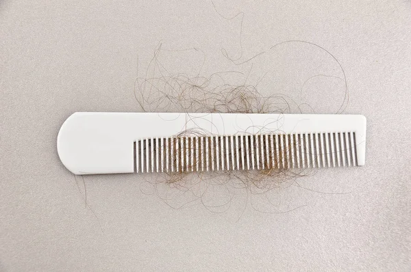 Close up of hair loss — Stock Photo, Image