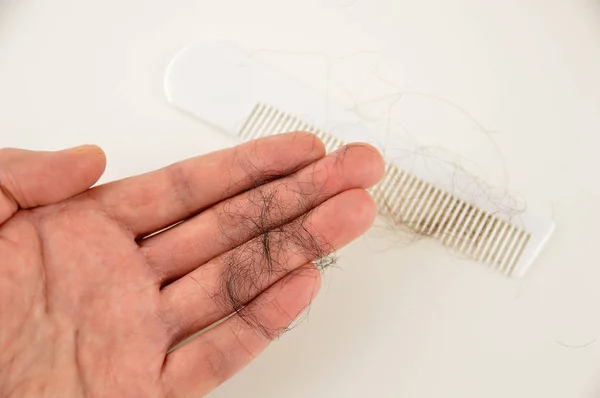 Hair loss is so worrying — Stock Photo, Image