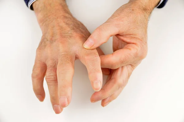 Pain in fingers — Stock Photo, Image