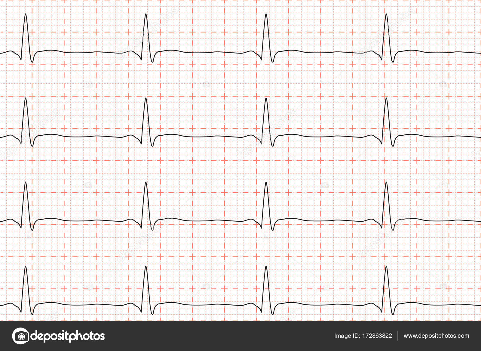 Heart Beat Chart