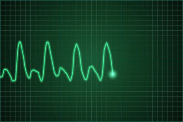 Pulso del monitor cardíaco. Línea de latidos del corazón. Gráfico de frecuencia cardíaca vectorial. Ilustración vectorial . — Vector de stock