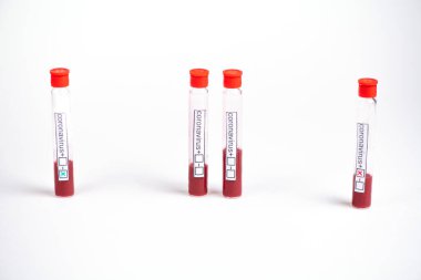 Coronavirus test tüpü ve kan.