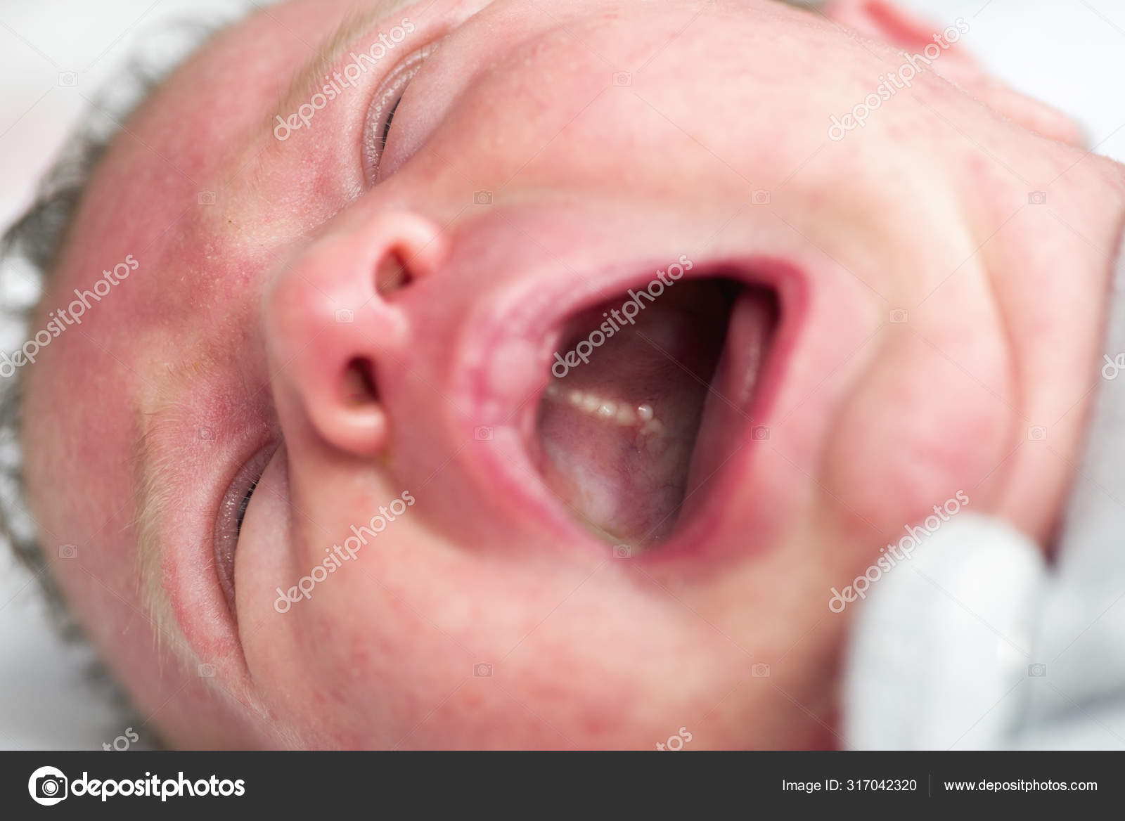 Small cysts in newborn mouth — Stock Photo © jarino #317042320