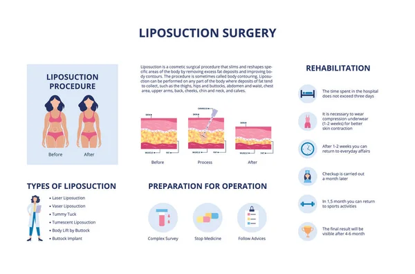 Chirurgia plastica del corpo liposuzione con caratteri e testo, illustrazione vettoriale . — Vettoriale Stock