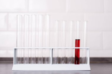 Laboratuvarda test tüpündeki kan.