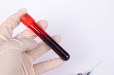 Kan örneğini tutan doktorun eline yaklaş. Tıbbi konsept resmi