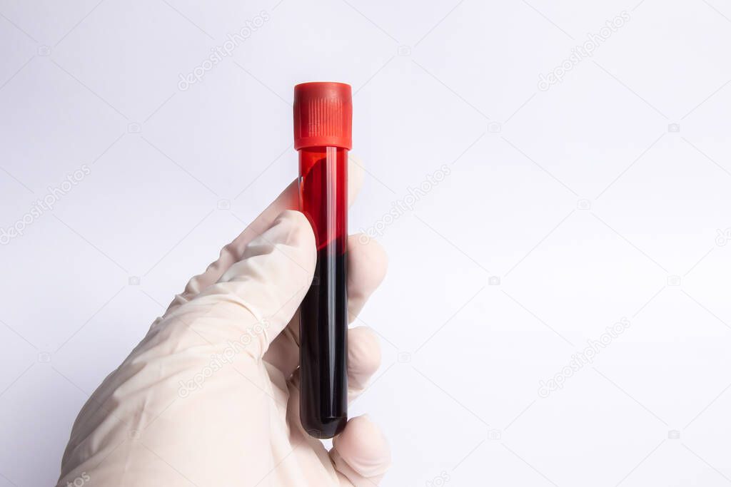Close up of doctor hand holding blood sample. Medical concept image