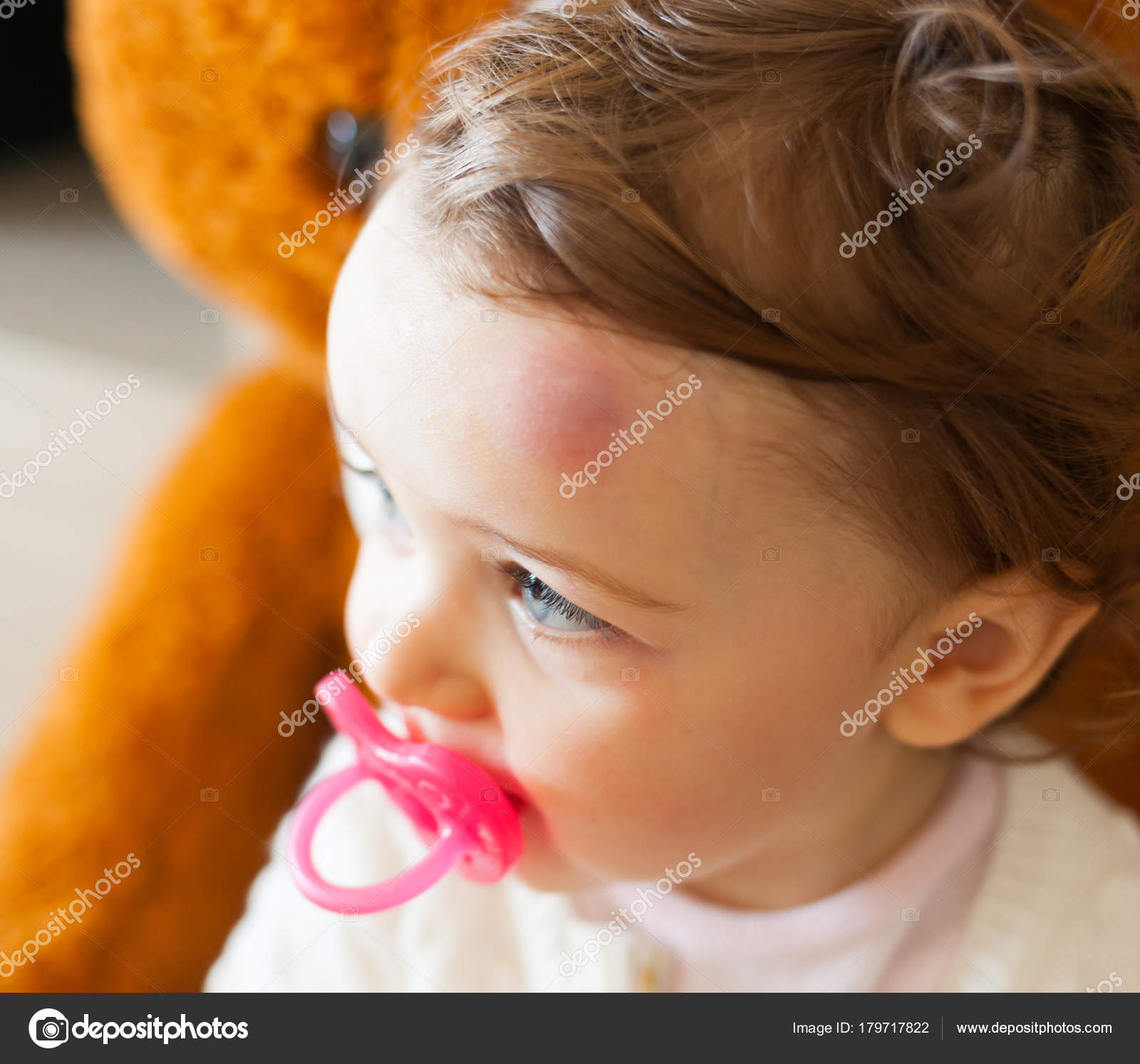 Enfant Bosse Tete Images Libres De Droit Photos De Enfant Bosse Tete Depositphotos