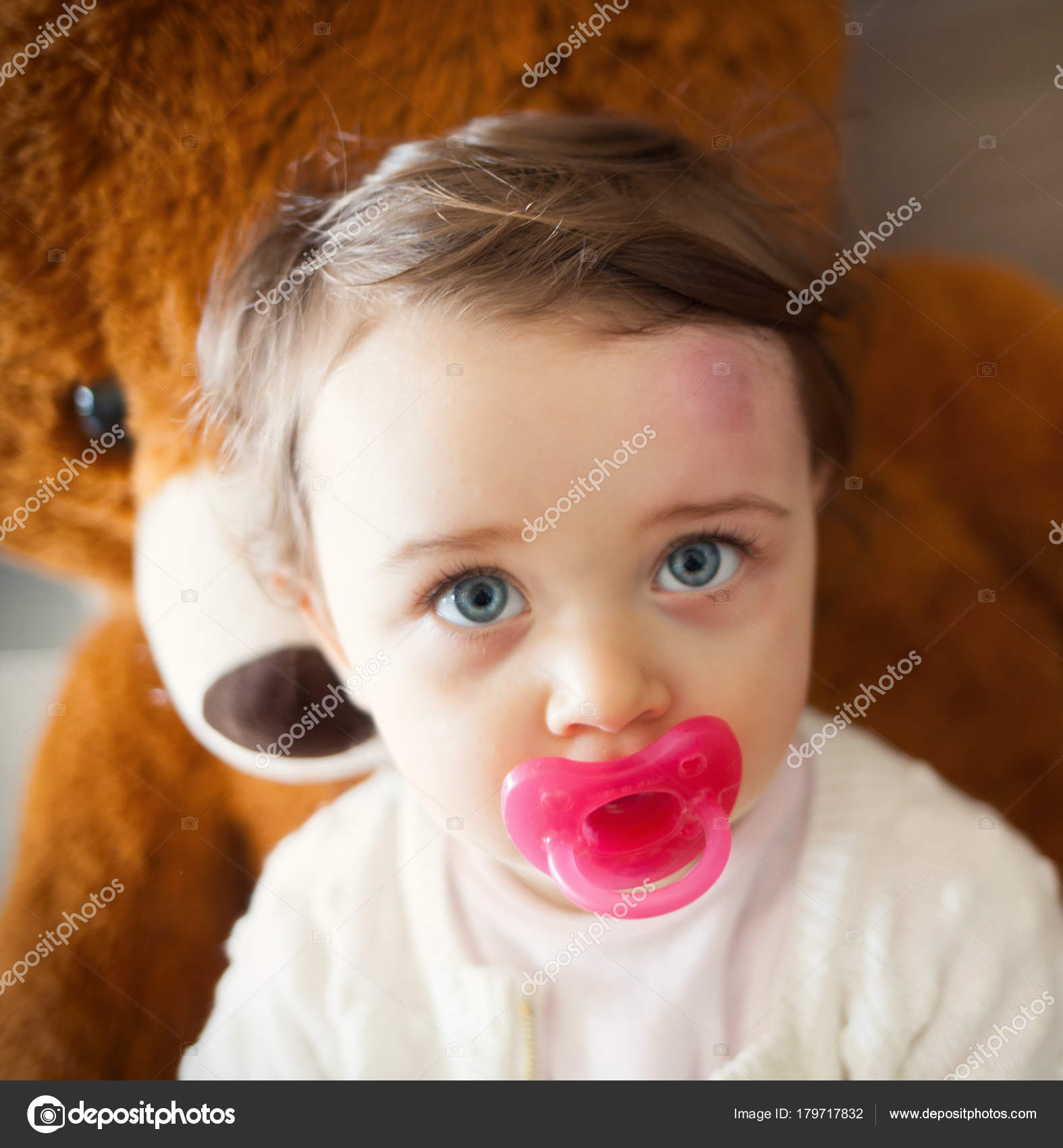 Enfant Bosse Tete Images Libres De Droit Photos De Enfant Bosse Tete Depositphotos