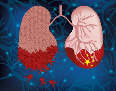 Coronavirus hastalığı solunum sistemine saldırır. 2019-Ncov Çin 'inde ölümcül Coronavirüs salgını. Bulaşıcı. Vektör illüstrasyonu