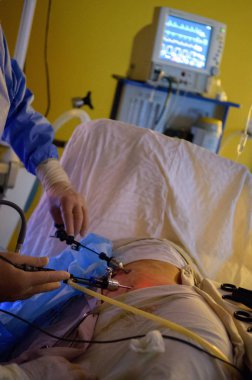 Laparoskopik Cerrahi operasyon