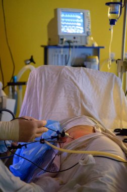 Laparoskopik Cerrahi operasyon