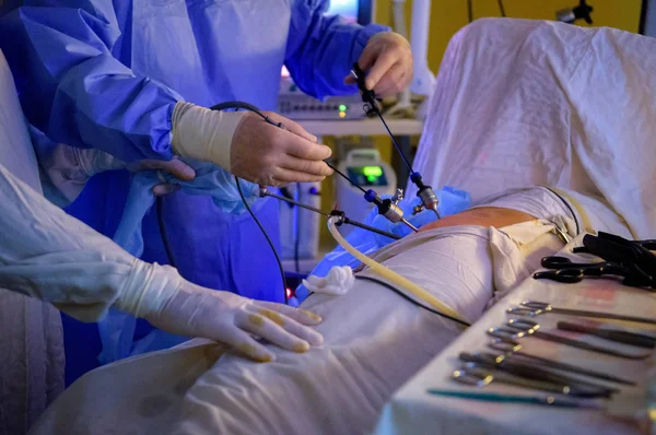 Chirurgii laparoskopowej operacji — Zdjęcie stockowe