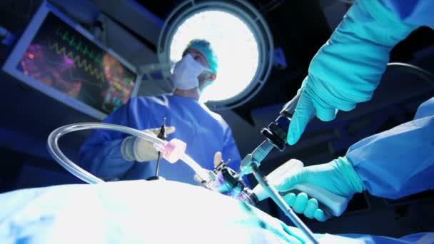 Laparoscopic surgical operation — Stock Video