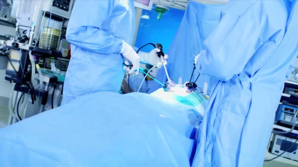 Подготовка команды больницы к операции по лапароскопии — стоковое видео