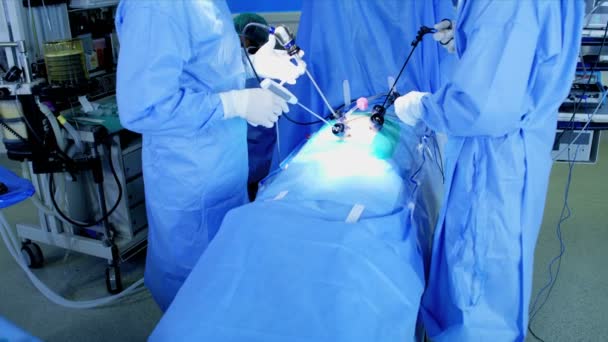 Surgical hospital Laparoscopic Operation — Stock Video