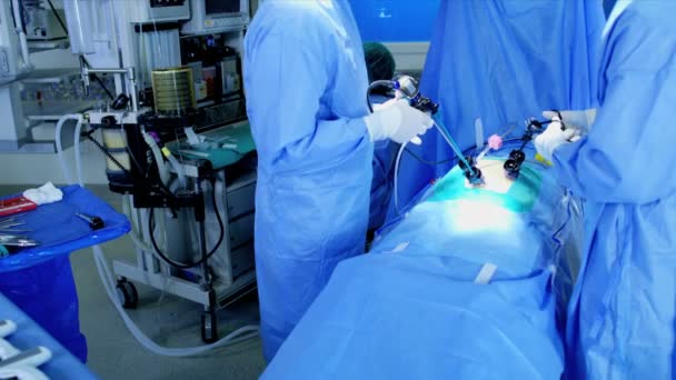 Surgeons performing Laparoscopic operation — Stock Video