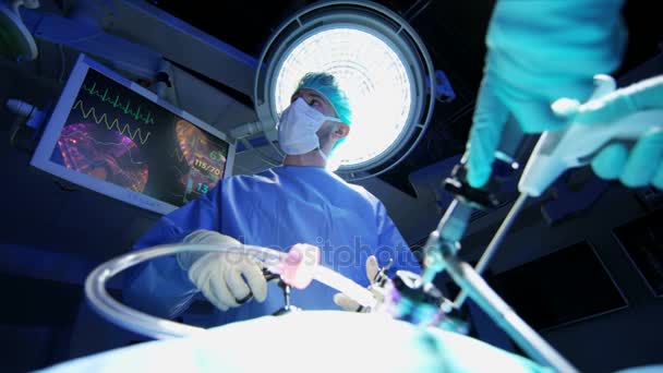 Проведение лапароскопической операции на пациенте — стоковое видео