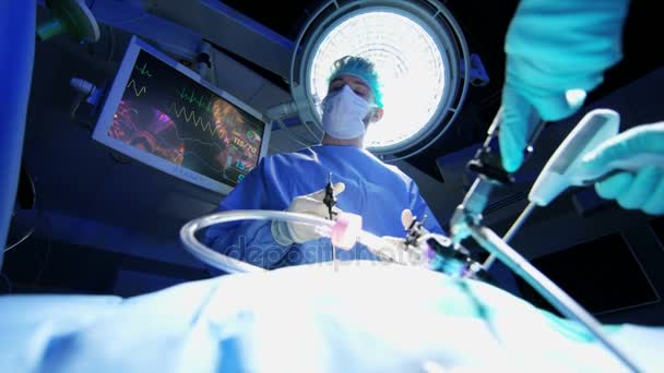 Проведение лапароскопической операции на пациенте — стоковое видео