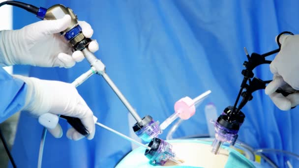 Laparoskopi işlemi gerçekleştirerek takım — Stok video