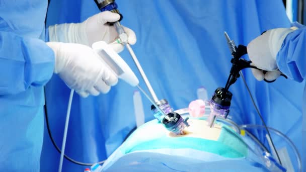 Operación quirúrgica realizada por cirujanos — Vídeos de Stock