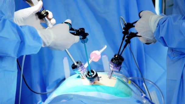 Équipe effectuant une opération de laparoscopie — Video