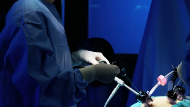 복 강경 수술을 수행 하는 외과 팀 — 비디오