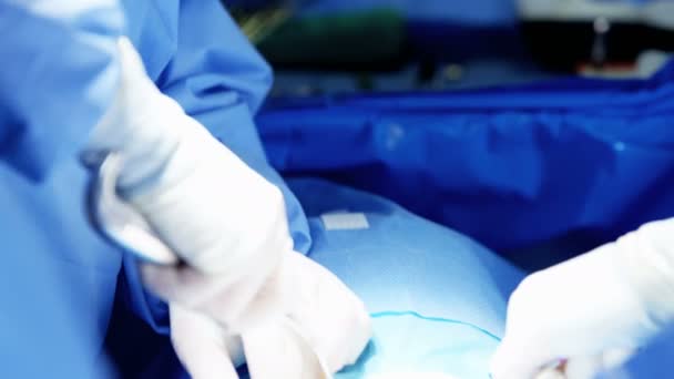 Equipe cirúrgica realizando cirurgia ortopédica — Vídeo de Stock