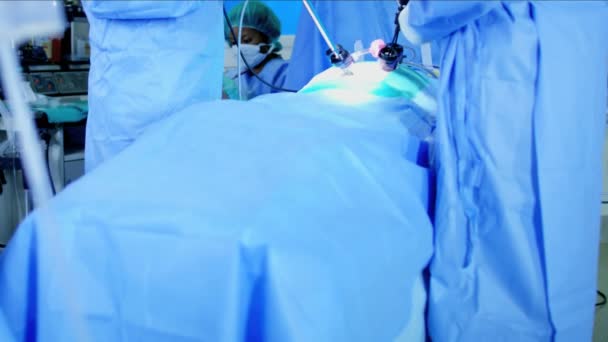 Operação cirúrgica laparoscópica — Vídeo de Stock