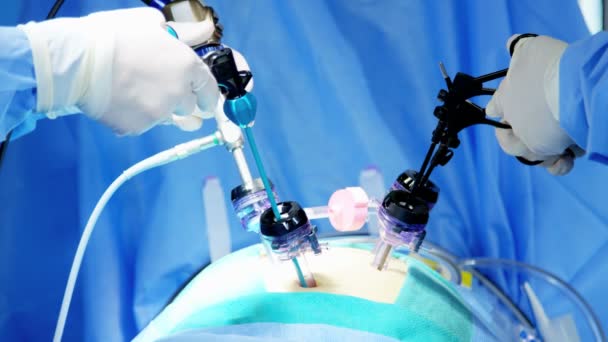 Surgical operation performed by surgeons — Stock Video