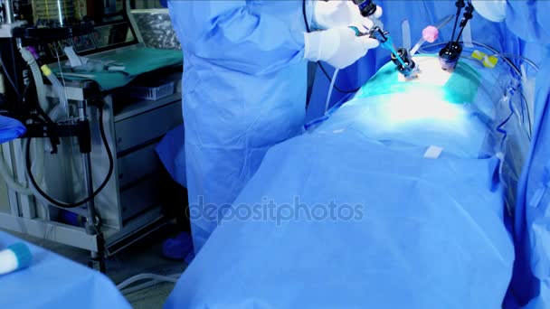 Chirurgische ziekenhuis laparoscopie operatie — Stockvideo