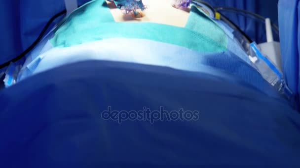 Opération chirurgicale effectuée par des chirurgiens — Video