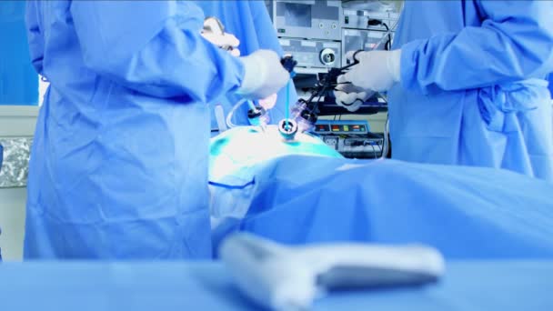 Equipe cirúrgica realizando operação — Vídeo de Stock