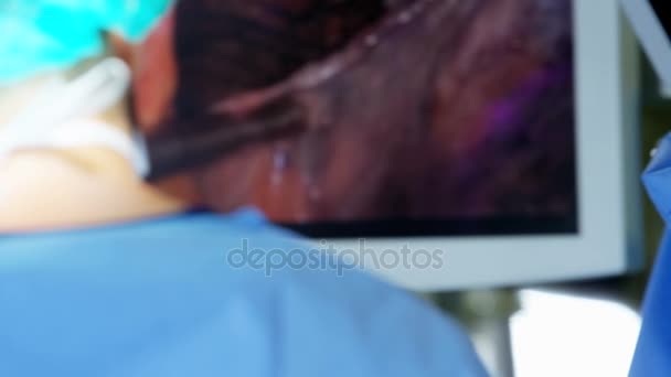 Laparoscopische chirurgische opleiding operatie — Stockvideo