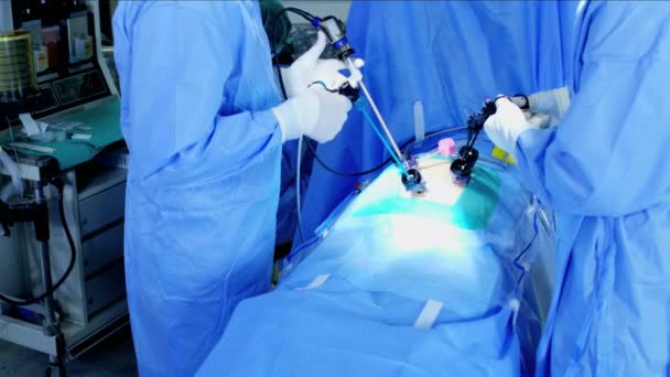 Laparoskopie chirurgické operace — Stock video