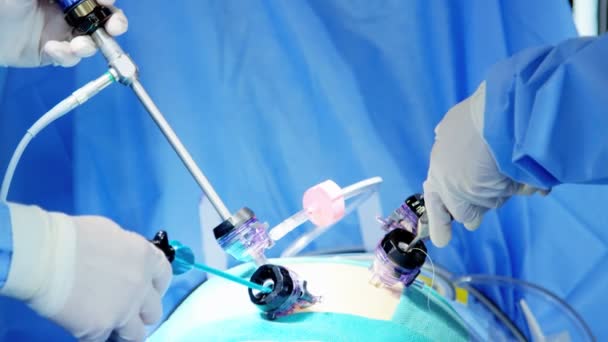 Operacja chirurgiczna, wykonywane przez lekarzy — Wideo stockowe