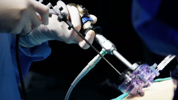 Surgical performing Laparoscopy operation — Stock Video