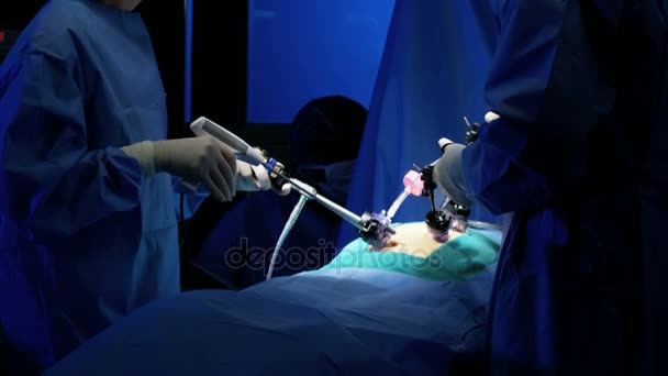 Team chirurgico che esegue chirurgia laparoscopica — Video Stock