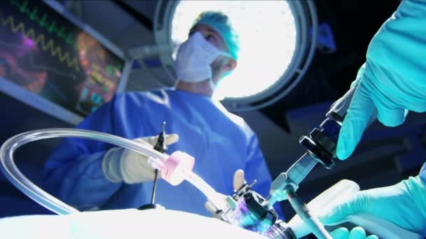 Laparoscopic surgical operation — Stock Video