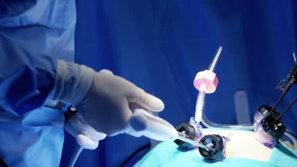 Surgical operation performed by surgeons — Stock Video