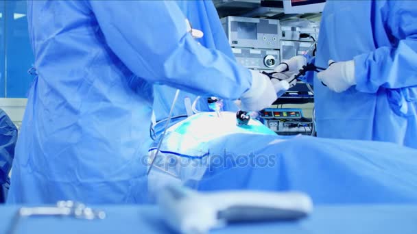 Лапароскопія хірургічна операція — стокове відео
